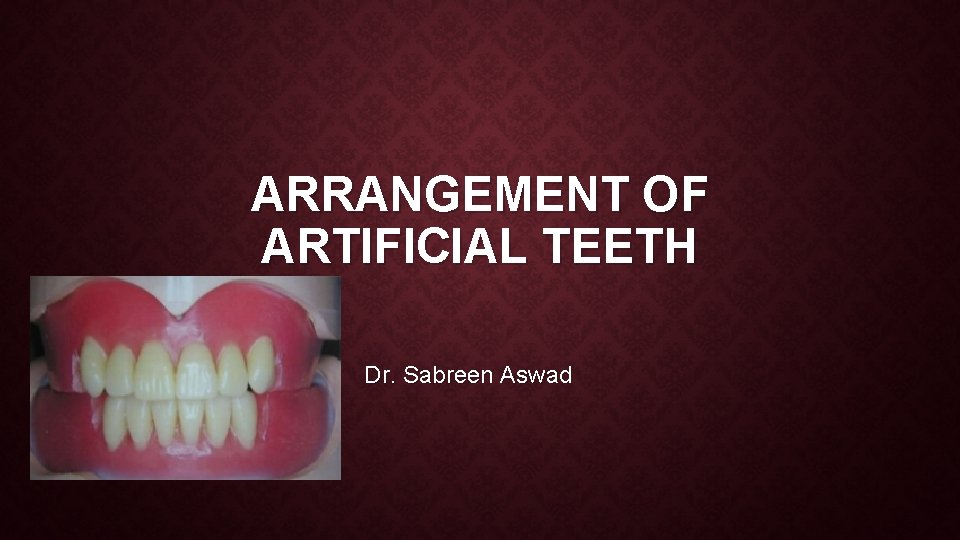 ARRANGEMENT OF ARTIFICIAL TEETH Dr. Sabreen Aswad 