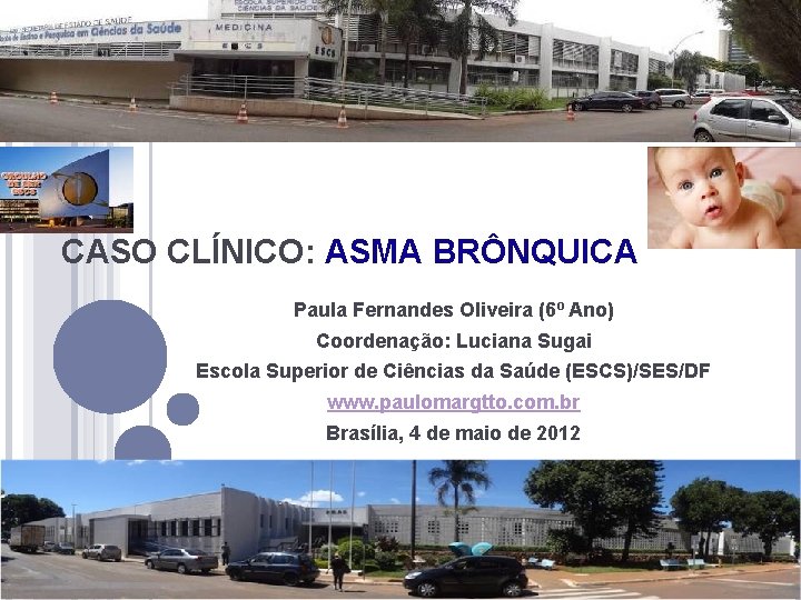 CASO CLÍNICO: ASMA BRÔNQUICA Paula Fernandes Oliveira (6º Ano) Coordenação: Luciana Sugai Escola Superior