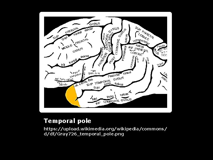 Temporal pole https: //upload. wikimedia. org/wikipedia/commons/ d/df/Gray 726_temporal_pole. png 