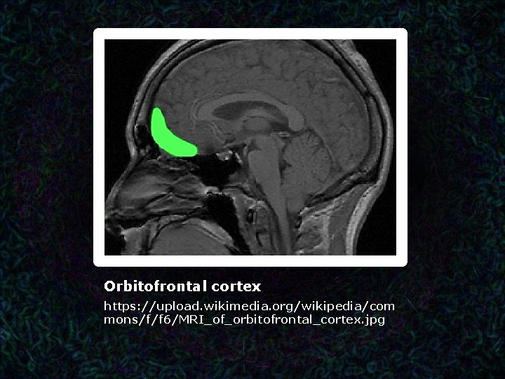 Orbitofrontal cortex https: //upload. wikimedia. org/wikipedia/com mons/f/f 6/MRI_of_orbitofrontal_cortex. jpg 