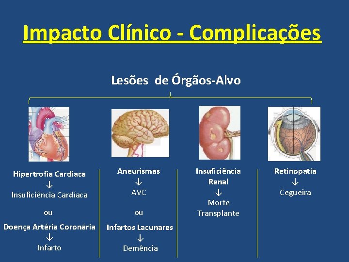 Impacto Clínico - Complicações Lesões de Órgãos-Alvo Hipertrofia Cardíaca ↓ Insuficiência Cardíaca Aneurismas ↓