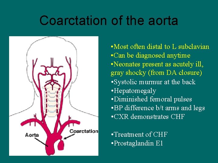 Coarctation of the aorta • Most often distal to L subclavian • Can be