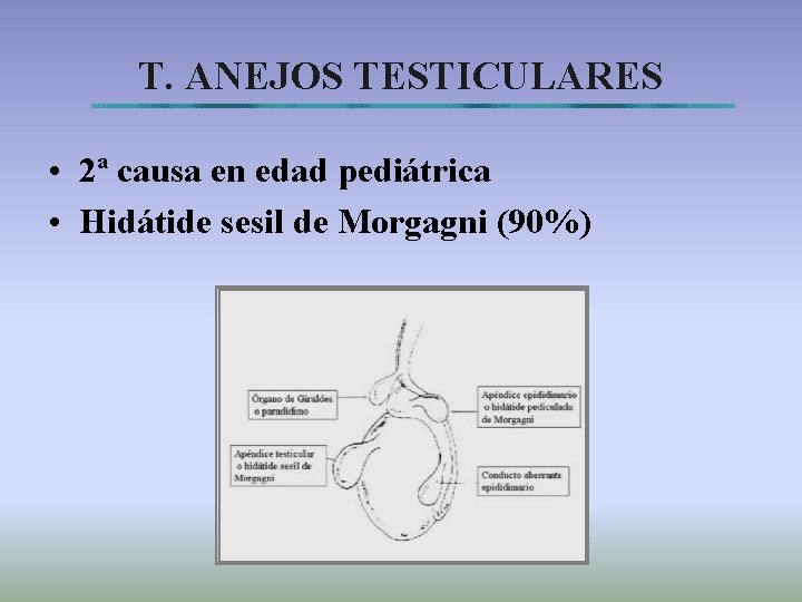 T. ANEJOS TESTICULARES • 2ª causa en edad pediátrica • Hidátide sesil de Morgagni
