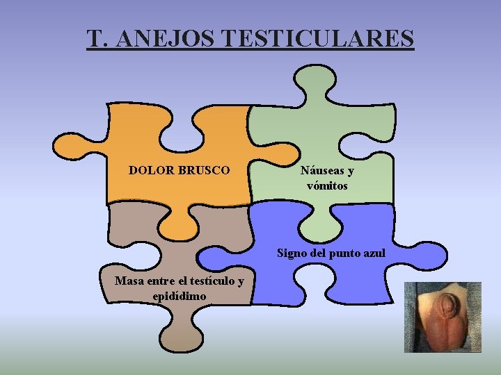 T. ANEJOS TESTICULARES DOLOR BRUSCO Náuseas y vómitos Signo del punto azul Masa entre