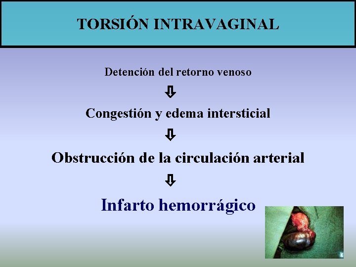 TORSIÓN INTRAVAGINAL Detención del retorno venoso Congestión y edema intersticial Obstrucción de la circulación