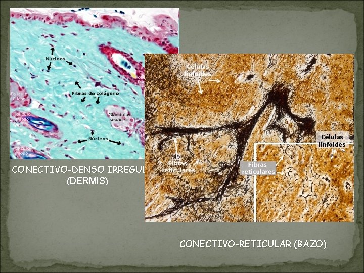 CONECTIVO-DENSO IRREGULAR (DERMIS) CONECTIVO-RETICULAR (BAZO) CONECTIVO-DENSO IRREGULAR (DERMIS) CONECTIVO-RETICULAR (BAZO)