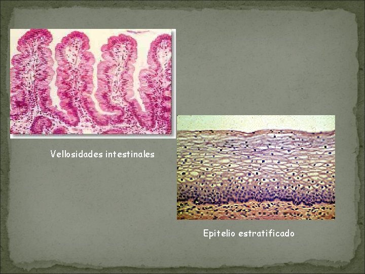 Vellosidades intestinales Epitelio estratificado Vellosidades intestinales Epitelio estratificado