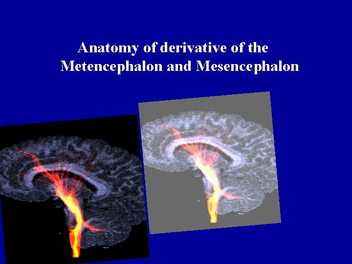 Anatomy of derivative of the Metencephalon and Mesencephalon 