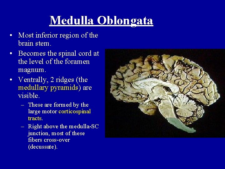 Medulla Oblongata • Most inferior region of the brain stem. • Becomes the spinal