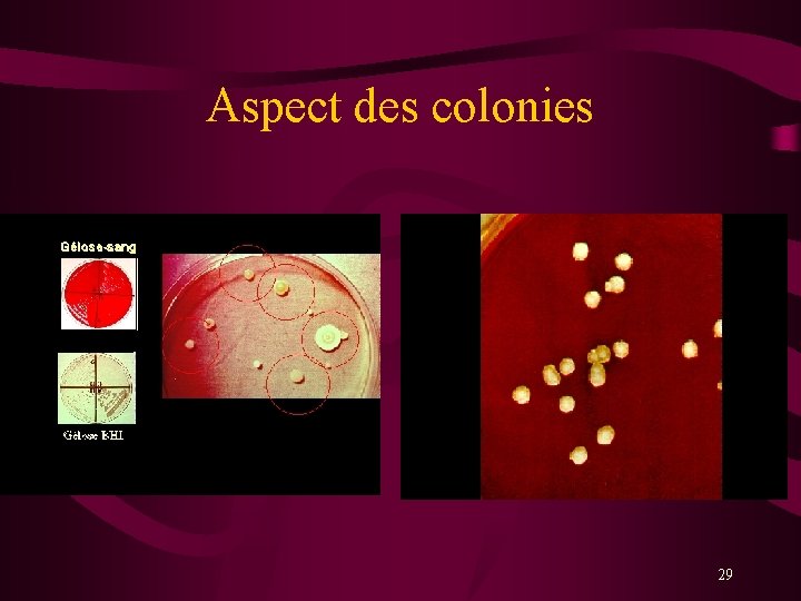 Aspect des colonies 29 