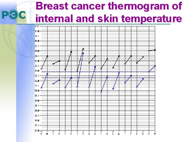 Breast cancer thermogram of internal and skin temperature Breast cancer thermogram of internal and skin temperature