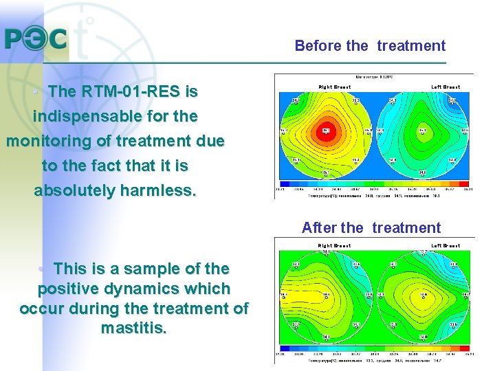 Before the treatment • The RTM-01 -RES is indispensable for the monitoring of treatment Before the treatment • The RTM-01 -RES is indispensable for the monitoring of treatment