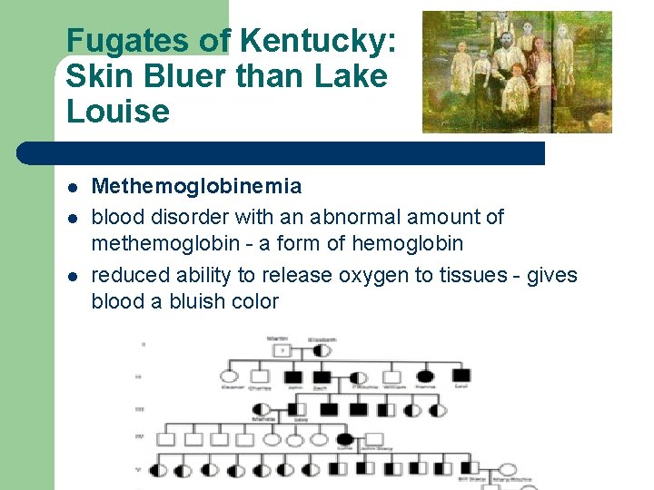 Fugates of Kentucky: Skin Bluer than Lake Louise l l l Methemoglobinemia blood disorder