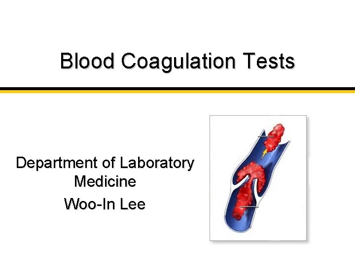 Blood Coagulation Tests Department of Laboratory Medicine Woo-In Lee 