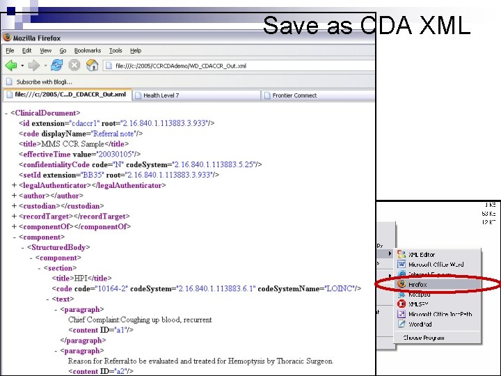 Save as CDA XML Save as CDA XML