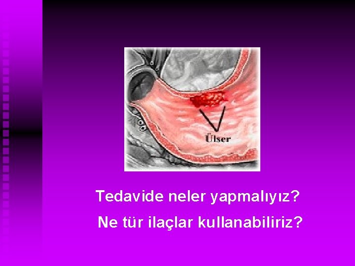 Tedavide neler yapmalıyız? Ne tür ilaçlar kullanabiliriz? 