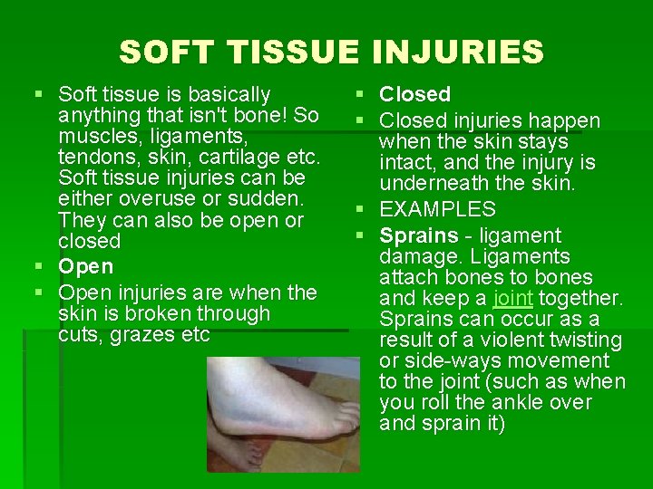 SOFT TISSUE INJURIES § Soft tissue is basically anything that isn't bone! So muscles,