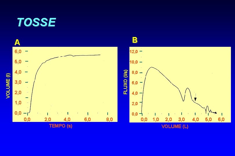 TOSSE B 6, 0 12, 0 5, 0 10, 0 FLUXO (l/s) VOLUME (l)