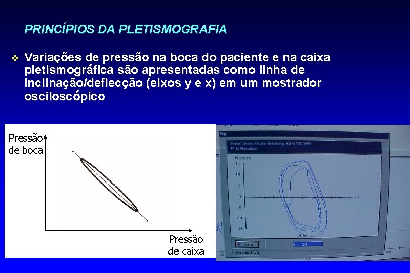PRINCÍPIOS DA PLETISMOGRAFIA v Variações de pressão na boca do paciente e na caixa