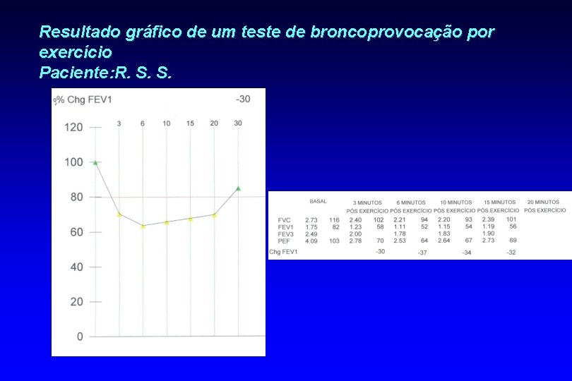 Resultado gráfico de um teste de broncoprovocação por exercício Paciente: R. S. S. 
