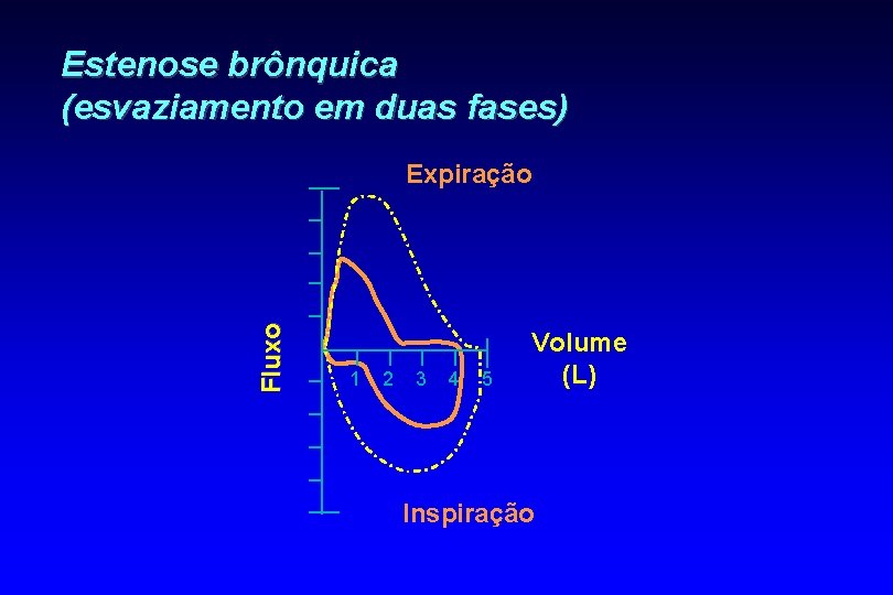 Estenose brônquica (esvaziamento em duas fases) Fluxo Expiração 1 2 3 4 5 Volume