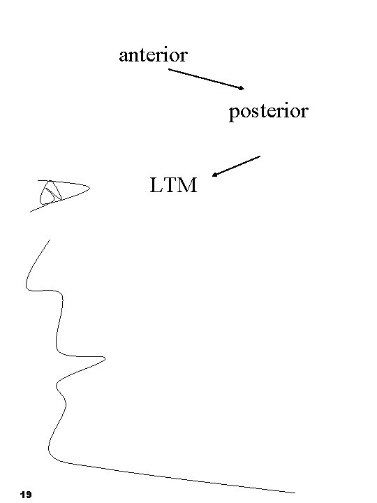 anterior posterior LTM 19 