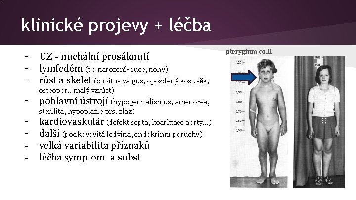 klinické projevy + léčba - UZ - nuchální prosáknutí lymfedém (po narození- ruce, nohy)