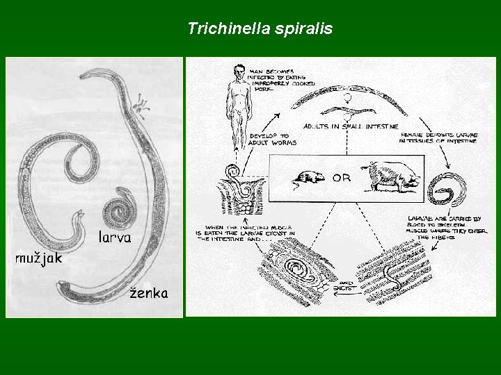 Trichinella spiralis 