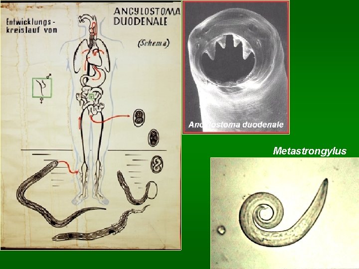 Metastrongylus 