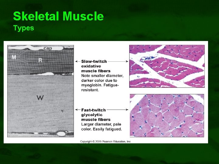 Skeletal Muscle Types 