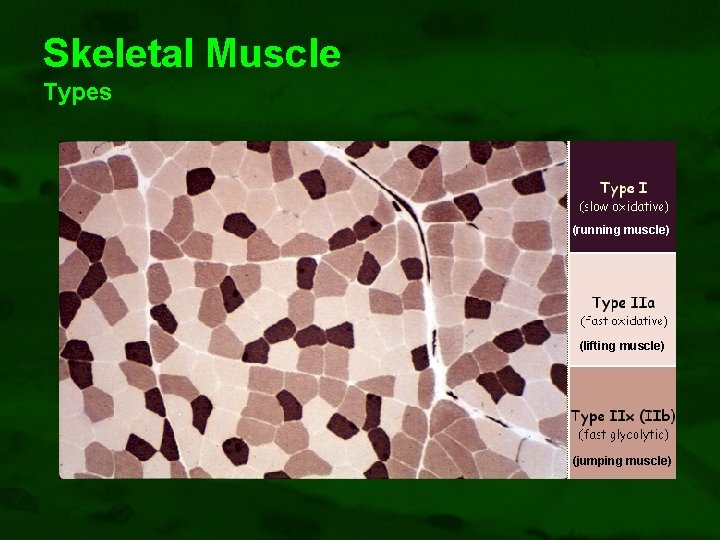 Skeletal Muscle Types (running muscle) (lifting muscle) (jumping muscle) 