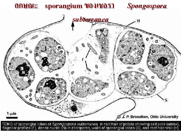 ลกษณะ sporangium ของเชอรา subterranea Spongospora 