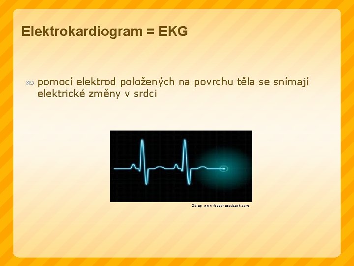 Elektrokardiogram = EKG pomocí elektrod položených na povrchu těla se snímají elektrické změny v