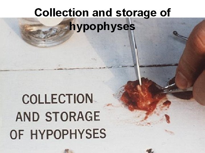 Collection and storage of hypophyses 