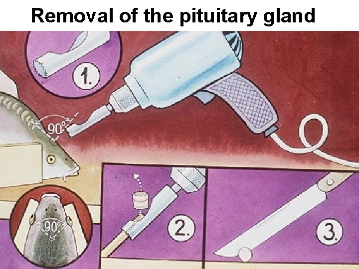 Removal of the pituitary gland 
