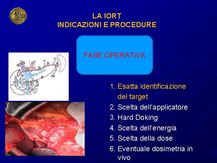 LA IORT INDICAZIONI E PROCEDURE FASE OPERATIVA 1. Esatta identificazione del target 2. Scelta