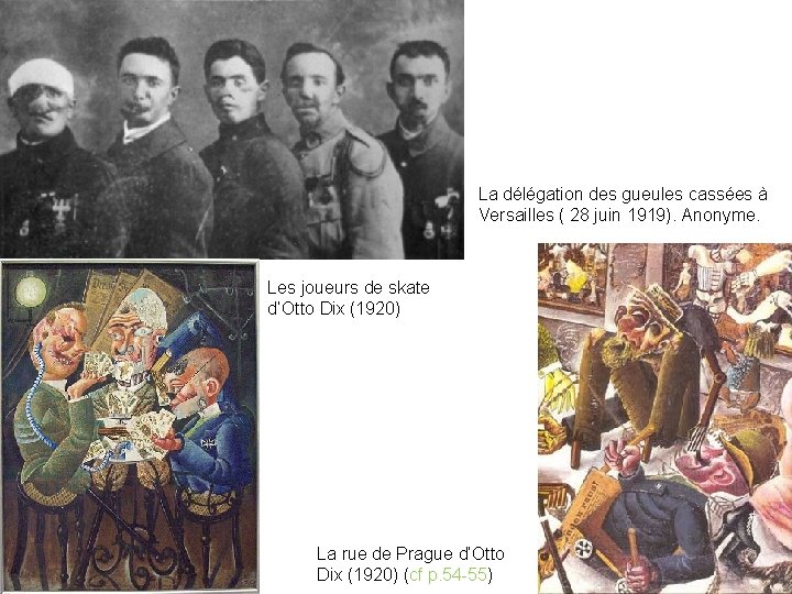 La délégation des gueules cassées à Versailles ( 28 juin 1919). Anonyme. Les joueurs