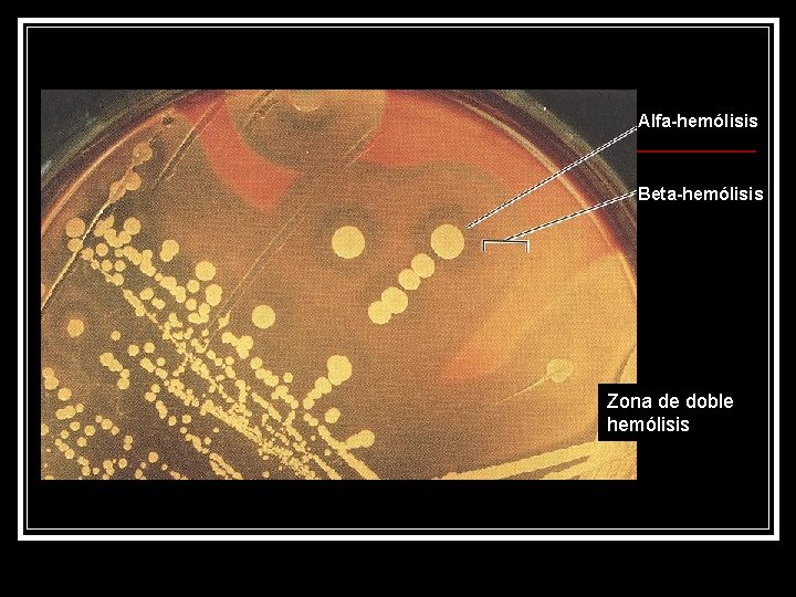 Alfa-hemólisis Beta-hemólisis Zona de doble hemólisis 