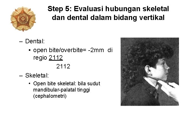 Step 5: Evaluasi hubungan skeletal dan dental dalam bidang vertikal – Dental: • open