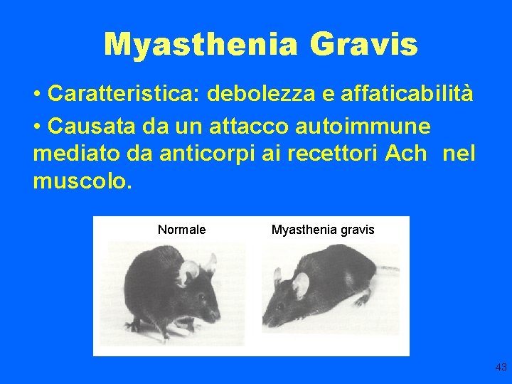 Myasthenia Gravis • Caratteristica: debolezza e affaticabilità • Causata da un attacco autoimmune mediato