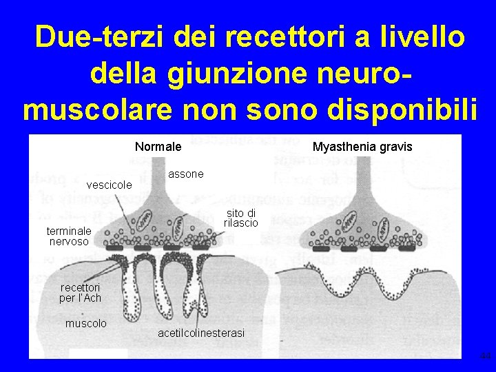 Due-terzi dei recettori a livello della giunzione neuromuscolare non sono disponibili Myasthenia gravis Normale