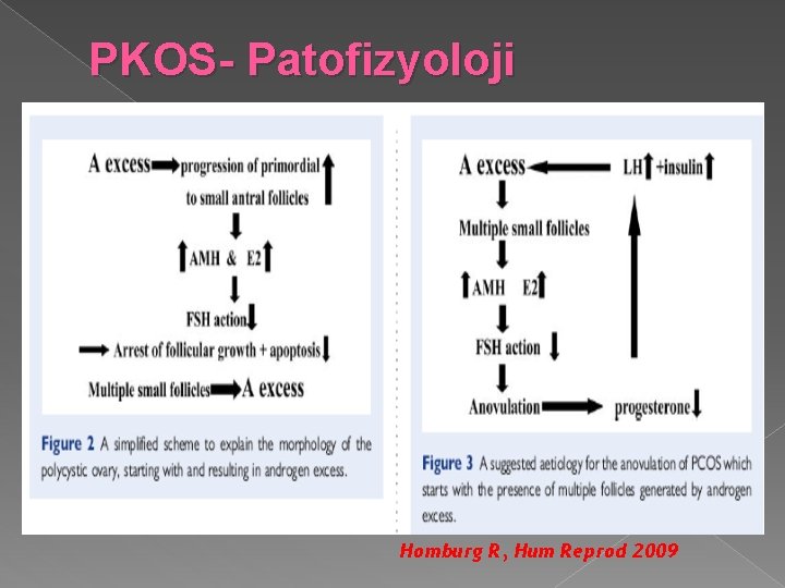 PKOS- Patofizyoloji Homburg R, Hum Reprod 2009 