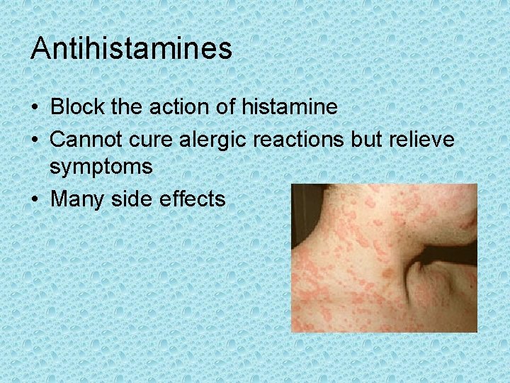 Antihistamines • Block the action of histamine • Cannot cure alergic reactions but relieve