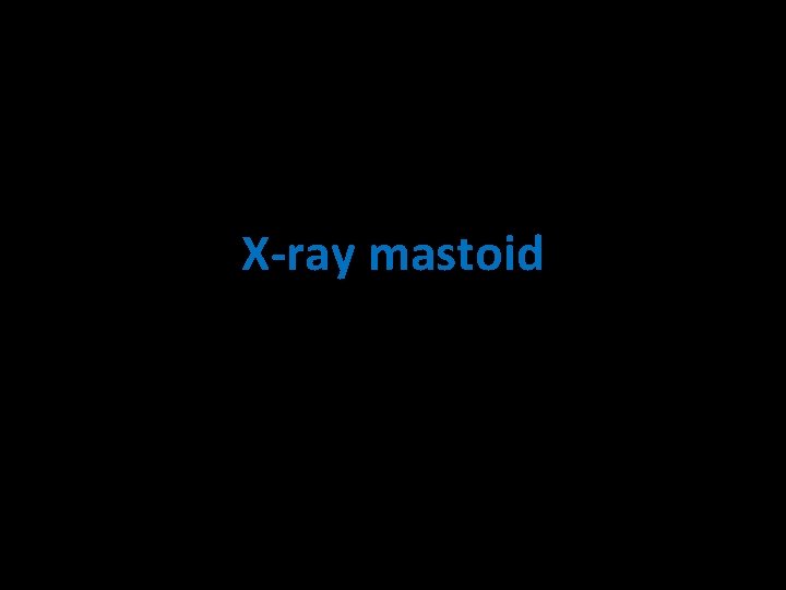 X-ray mastoid 