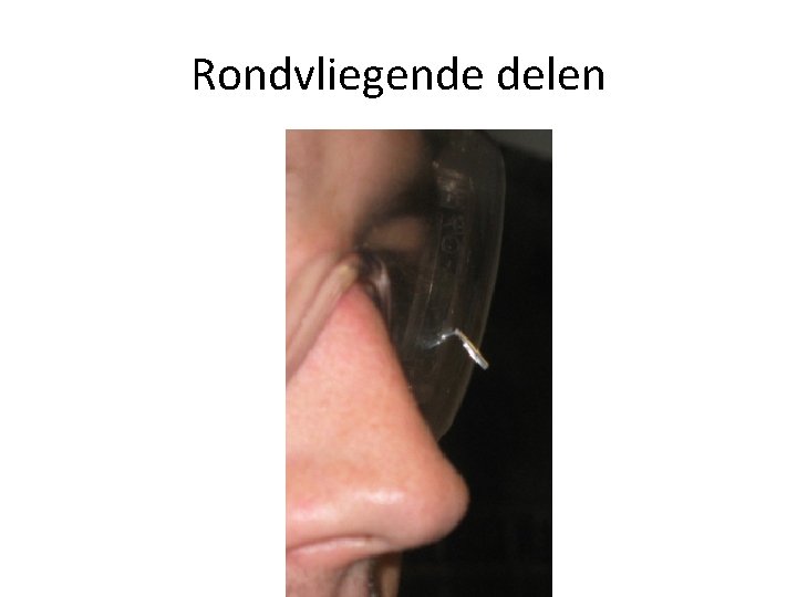 Rondvliegende delen 