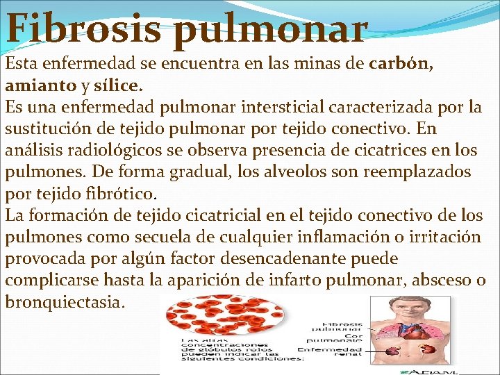 Fibrosis pulmonar Esta enfermedad se encuentra en las minas de carbón, amianto y sílice.