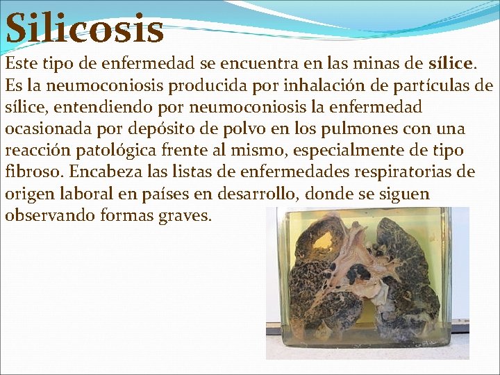 Silicosis Este tipo de enfermedad se encuentra en las minas de sílice. Es la