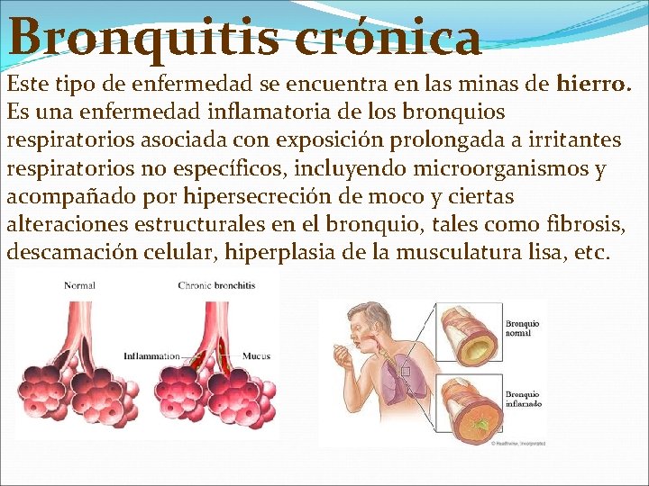 Bronquitis crónica Este tipo de enfermedad se encuentra en las minas de hierro. Es