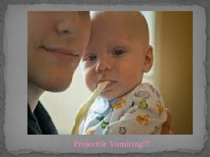 Is It Normal For An Infant To Projectile Vomit