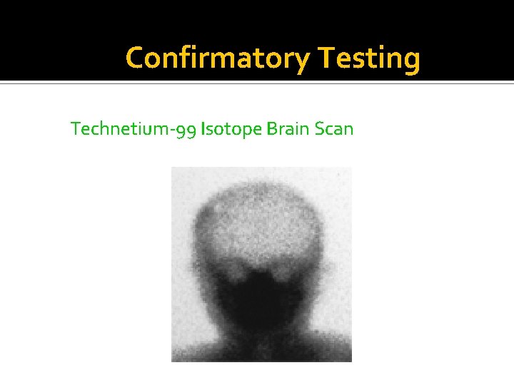 Confirmatory Testing Technetium-99 Isotope Brain Scan 